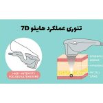 دستگاه هایفو اولترا 7 بعدی