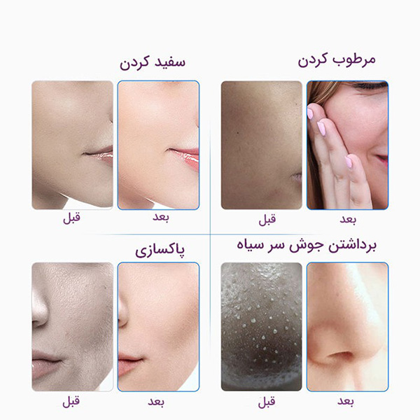 هیدروفیشیال 7 کاره نیوفیس موتور سنگین