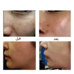 ژل کربن تراپی 300 میلی لیتر تایگیت - Image 4